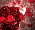 Наружные симптомы у больных с тромбоэмболией легочной артерии