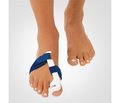Лечение Hallux Valgus методом открытой дистальной остеотомии с параоссальной фиксацией