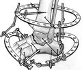 Результаты лечения переломов длинных костей нижних конечностей c применением принципов «биологического» остеосинтеза