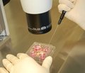 Эффективность стимуляции суперовуляции в программах ВРТ у женщин с предшествующими оперативными вмешательствами на придатках матки