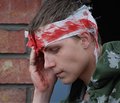 Применение неполного парентерального питания в интенсивной терапии тяжелой черепно-мозговой травмы с использованием современного аминокислотного раствора Аминосол® НЕО